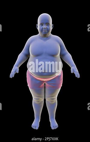 Ragazzo obeso, illustrazione Foto Stock