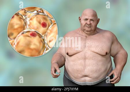 Uomo obeso e cellule grasse, illustrazione Foto Stock