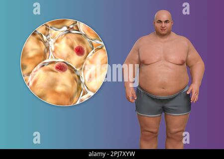 Uomo obeso e cellule grasse, illustrazione Foto Stock