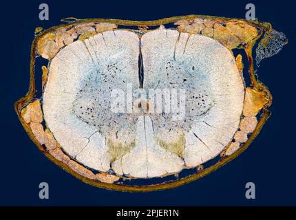 MIDOLLO SPINALE TS. Midollo spinale mammifero,TS. illuminazione del campo scuro Foto Stock