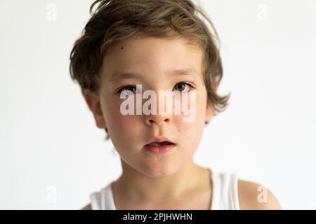 Il ragazzo era gonfio dalle allergie. Allergia da polline o cibo. Foto Stock