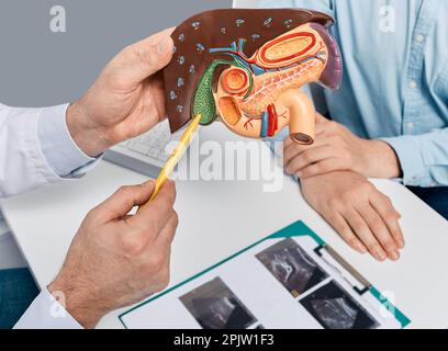 Trattamento delle malattie della cistifellea e del fegato in medicina, immagine concettuale. Gastroenterologo che mostra modello anatomico di fegato con cistifellea a pa Foto Stock