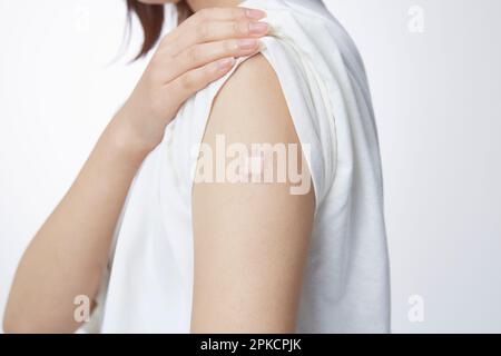 Dopo le iniezioni su due braccia di una donna Foto Stock