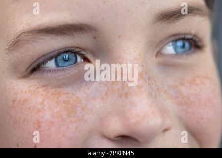 Primo piano. Parte anatomica. Giovane faccia felice e gioiosa in lenticelle, occhi blu di un bambino, adolescente, guardando via. Foto Stock