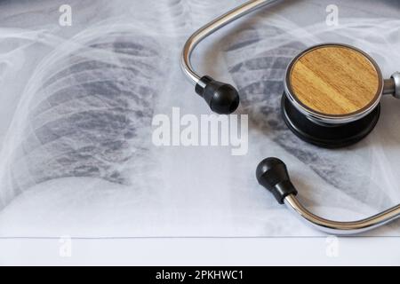 Immagine fluorografica dei polmoni su carta e uno stetoscopio, polmoni sani di un uomo per un esame di routine Foto Stock