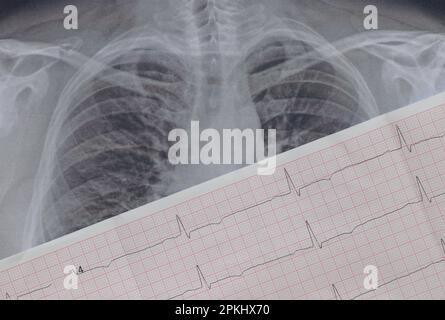 Immagine fluorografica dei polmoni su carta primo piano e un cardiogramma su carta, polmoni umani sani per un esame di routine Foto Stock