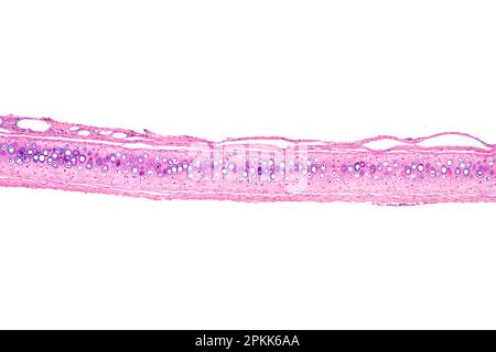 Cellule ossee, sezione, micrografia a luce 20X. Osso compatto con osteoni o sistema o canali haversiani, colorato con ematossilina-eosina, al microscopio ottico. Foto Stock