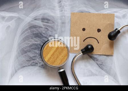 Un'immagine fluorografica dei polmoni su carta e uno stetoscopio e un emoticon triste sono disegnati su carta, salute e diagnostica, tristezza Foto Stock