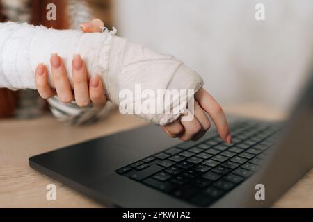 Dettaglio ritagliato scatto di irriconoscibile donna infortunata freelancer con la mano destra rotta avvolto in gesso bianco bendaggio di lavoro digitando sul computer portatile Foto Stock