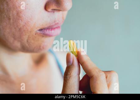 Brasile. 11th Apr, 2023. In questa illustrazione della foto, una donna ha visto prendere una pillola di medicina. (Credit Image: © Rafael Henrique/SOPA Images via ZUMA Press Wire) SOLO PER USO EDITORIALE! Non per USO commerciale! Foto Stock