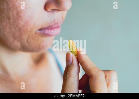 Brasile. 11th Apr, 2023. In questa illustrazione della foto, una donna ha visto prendere una pillola di medicina. (Foto di Rafael Henrique/SOPA Images/Sipa USA) Credit: Sipa USA/Alamy Live News Foto Stock