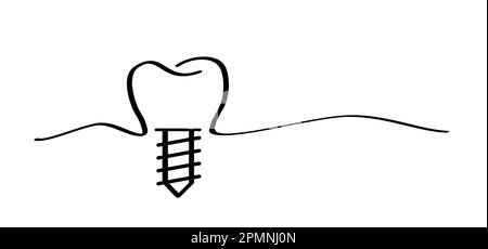 Impianto dentale, medico accurato o ponte dentale. Cartone animato sano, dente con le gengive. Schema della linea molare. Disegno del dente con vite. Danneggiare i denti o Foto Stock