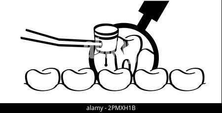 Dentale o dentale per clinica dentale. Dente cartoon con gengive e drill, logo molare. Danneggiare la spazzola per denti o la spazzola per denti con carie. M Foto Stock