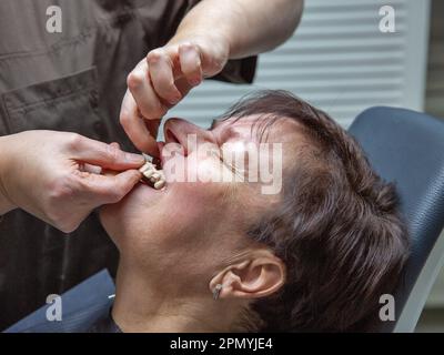 Dentista che lavora con un paziente in un dentista. Modello plastico di una protesi dentale permanente ceramica-metallo su impianti di primo piano Foto Stock