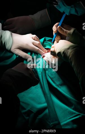 Primo piano delle mani di un chirurgo che effettua un'incisione nella pelle di un paziente. Bisturi sterile, aspiratore e guanti sterili su campo sterile verde. Foto Stock