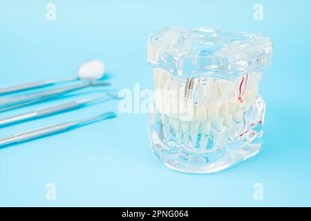 Modello di protesi mascellari o acriliche con impianti e attrezzi dentali su sfondo blu. Foto Stock