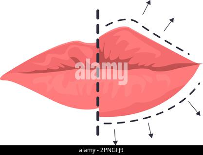 Illustrazione dell'aumento delle labbra in stile cartoon a colori. Disegno grafico vettoriale modificabile. Illustrazione Vettoriale