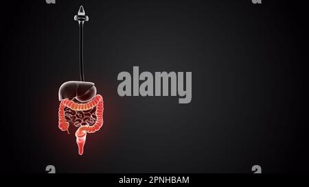 Corpo umano con intestino crasso Foto Stock