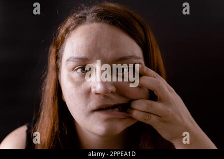 Freaky malata donna che tira la pelle di faccia a fianco con le dita. Dolore, bruttezza sopra la faccia. Persona mentalmente malsana. Foto Stock