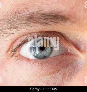 Macro di un occhio umano con eterocromia. Estremo primo piano dell'occhio umano di due diversi colori: Blu e marrone Foto Stock