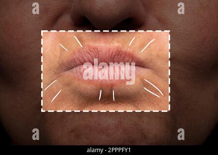 Le linee di espressione nella bocca di una donna. Labbra invecchiate evidenziate. Linee di invecchiamento sulle rughe della bocca Foto Stock