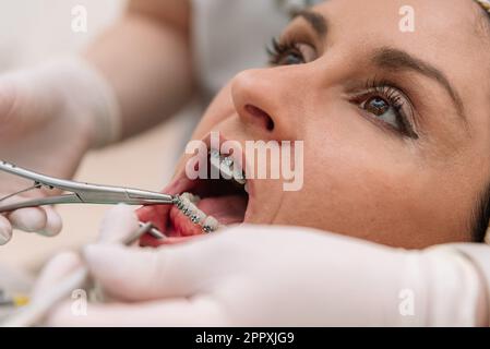 Ritagliare un dentista irriconoscibile in guanti di lattice utilizzando strumenti dentali mentre si mettono le bretelle sui denti della paziente femminile in clinica Foto Stock