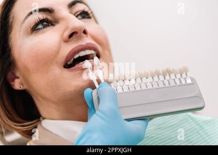 Dentista irriconoscibile in guanti di lattice che dimostrano le veneers dentali durante il lavoro con il paziente durante il trattamento medico Foto Stock