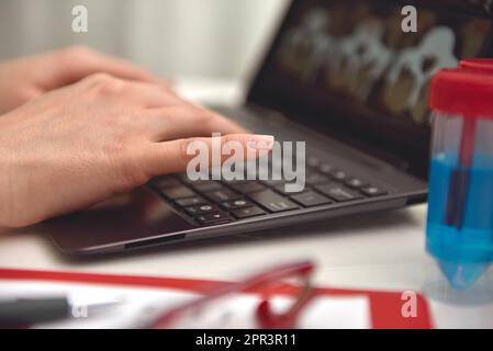 Le mani del medico femminile che scrivono sul laptop con i raggi X della colonna vertebrale sullo schermo Foto Stock