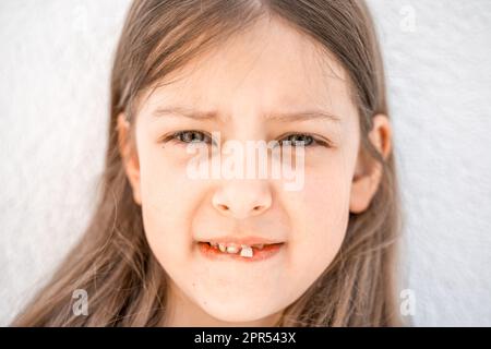 Affascinante ragazzina sorridente con la bocca aperta mostra sconcertante sciolto cadere fuori il primo dente anteriore del latte del bambino. Sostituzione dei denti del diffusore. Sano Foto Stock