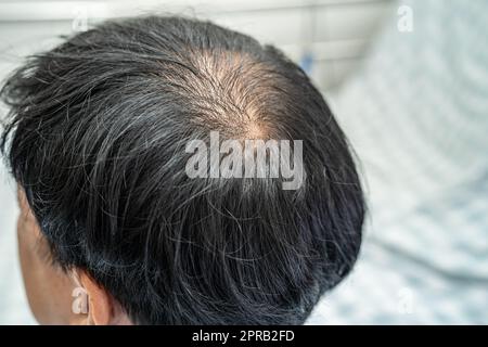 Calvo nella testa centrale e iniziare nessun capelli di perdita glabrous dell'uomo attivo maturo asiatico di ufficio intelligente di affari. Foto Stock