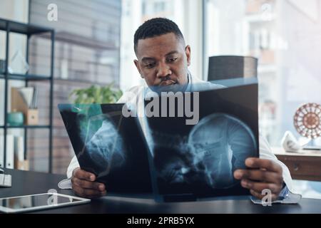 Prevenire è meglio che curare, un medico giovane che esamina una radiografia in un ufficio. Foto Stock