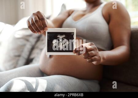 In attesa di incontrare il mio piccolo. Primo piano di una donna irriconoscibile che tiene un sonogramma a casa. Foto Stock