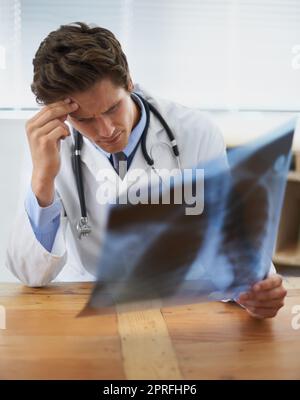 Questo sembra serio. un giovane medico che guarda interessato che esamina una radiografia toracica Foto Stock