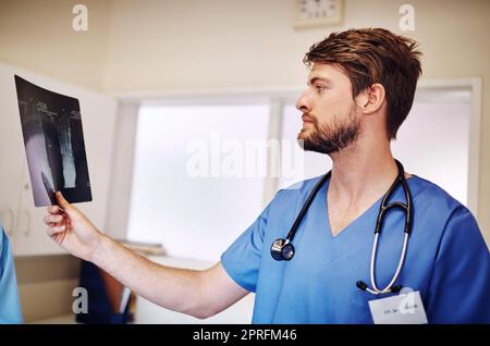 HES cercando di capire una diagnosi. Un giovane medico che analizza una radiografia da solo nel suo ufficio. Foto Stock