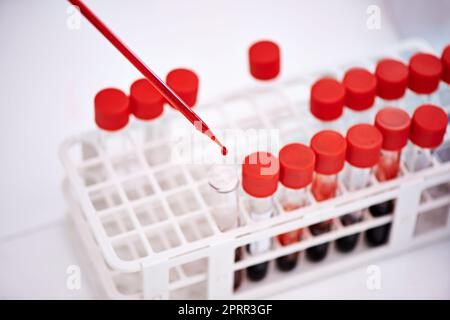 Basta una sola goccia. Primo piano di uno scienziato che lavora con campioni di sangue in laboratorio. Foto Stock