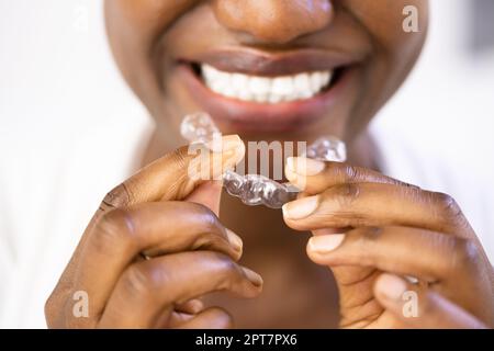 Cancellare la protezione notturna dentale dell'allineatore per i denti Foto Stock