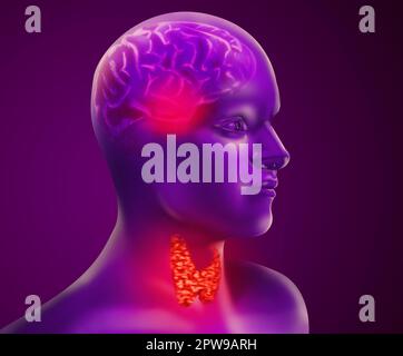 Illustrazione dell'uomo con ghiandola tiroidea infiammata su sfondo colorato Foto Stock