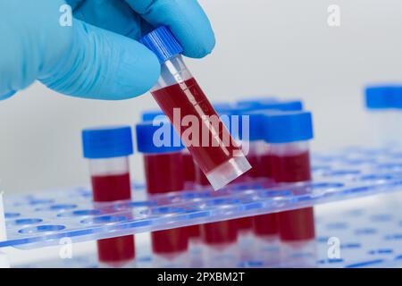 primo piano di manipolazione delle provette con sangue in un rack Foto Stock