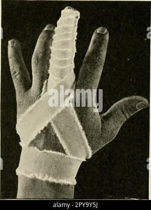 "Un libro di testo di pronto soccorso e di trattamento d'urgenza" (1917) Foto Stock