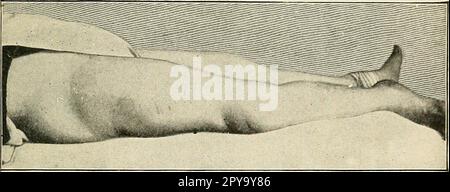 "Un libro di testo di pronto soccorso e di trattamento d'urgenza" (1917) Foto Stock