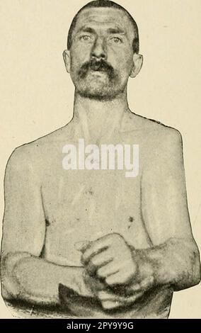 "Un libro di testo di pronto soccorso e di trattamento d'urgenza" (1917) Foto Stock