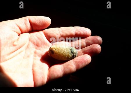 Malattia di calcoli biliari, colelitiasi - la formazione di calcoli, calcoli nella cistifellea, dotti biliari. Calcoli biliari. Un grande calcoli biliari rimosso dal corpo di un paziente, lungo 2,5 cm. Foto Stock