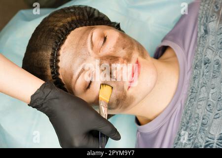 Il cosmetologo applica il nanoogel di carbonio del volto del cliente. Preparazione per il trattamento laser della pelle. Pelatura del viso in carbonio. Cosmetologia hardware Foto Stock