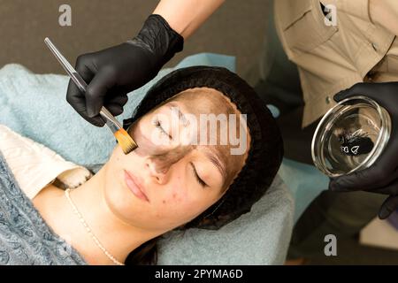 Сosmetician applica il nanogel di carbonio del volto del cliente. Preparazione per il trattamento laser della pelle. Pelatura del viso in carbonio. Cosmetologia hardware. Scienza della pelle Foto Stock