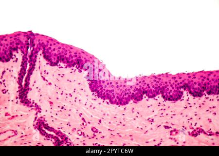 Epitelio squamoso stratificato umano al microscopio, micrografia leggera Foto Stock