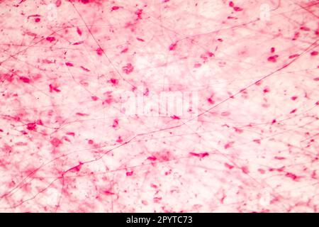Colorazione di tessuto connettivo umano sfuso, fotomicrografia leggera, ematossilina ed eosina Foto Stock