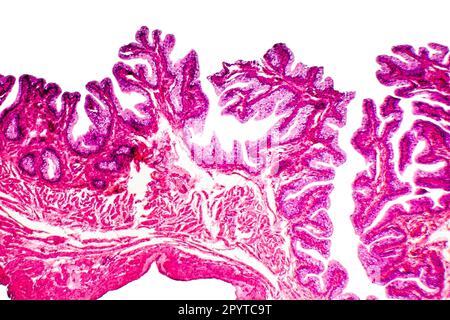 Tessuto epiteliale transitorio della vescica urinaria al microscopio, micrografia leggera, colorazione con ematossilina eosina Foto Stock