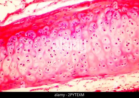 Cartilagine ialina della trachea umana, micrografia leggera Foto Stock