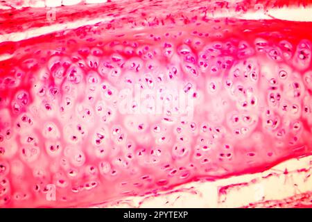 Cartilagine ialina della trachea umana, micrografia leggera Foto Stock