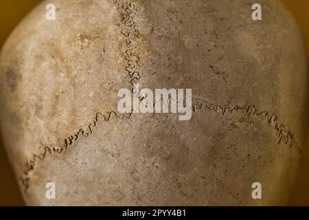 Primo piano vista dall'alto di un cranio in un museo della medicina Foto Stock